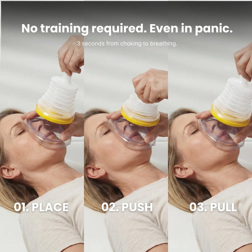 BreathBack® Anti-Choking Rescue Kit