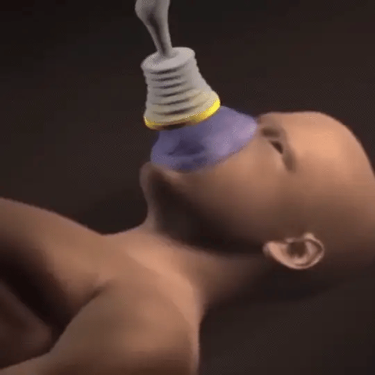 3. Why Suction Works When Compression Can't
